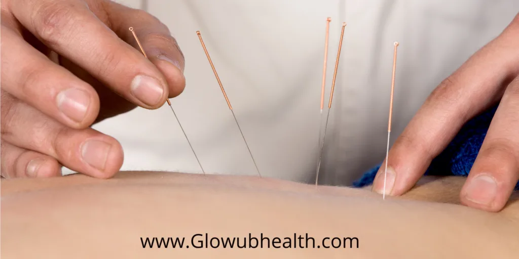 benefits of acupuncture