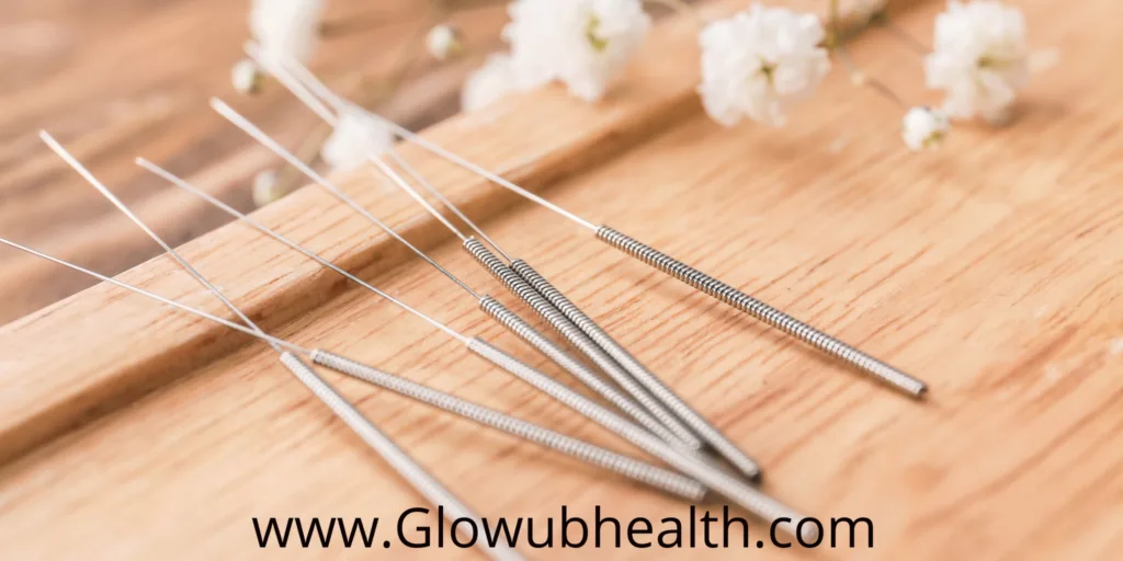 benefits of acupuncture