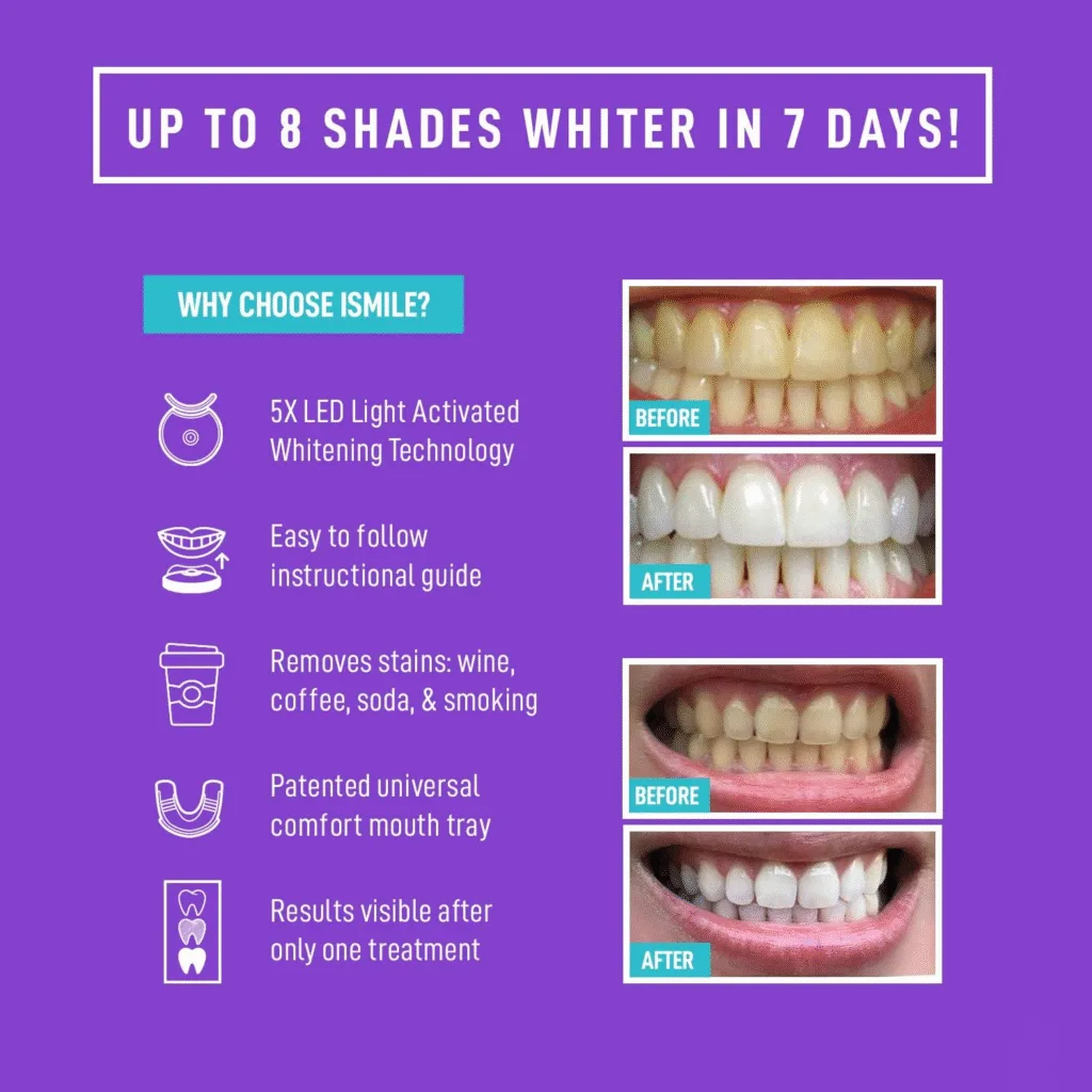 teeth whitening kit led