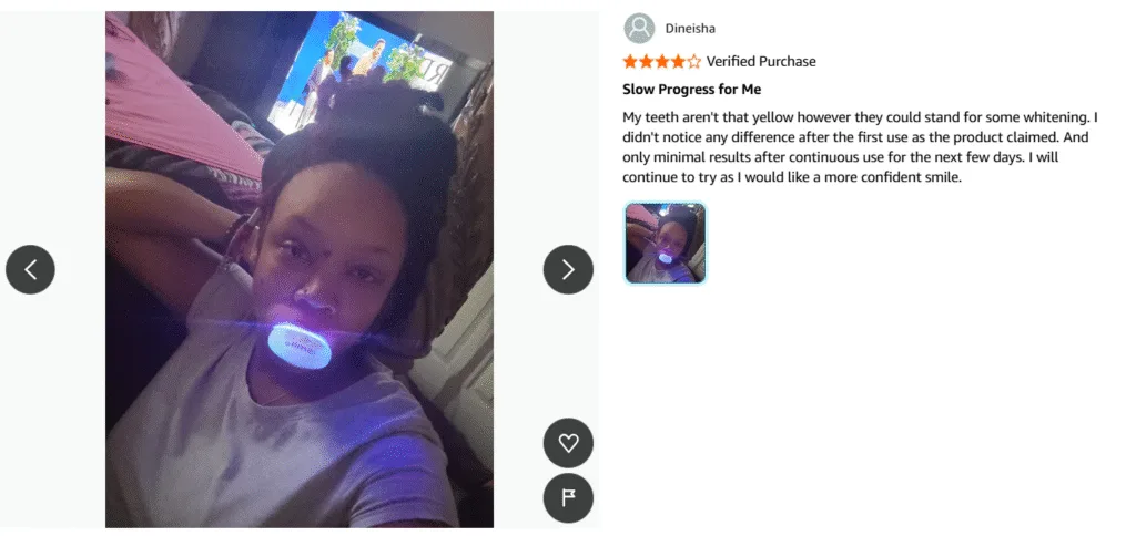 LED teeth whitening kits